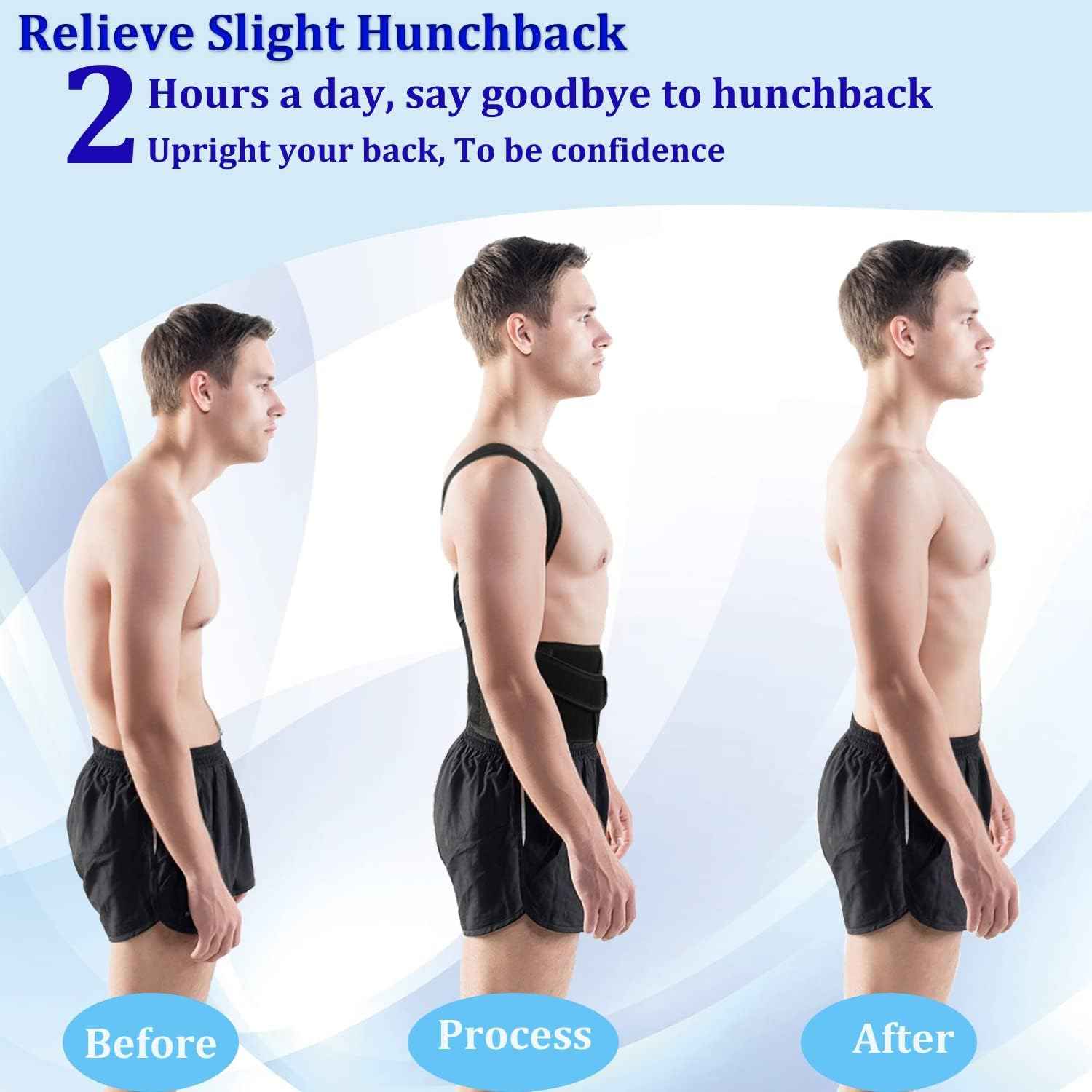 Adjustable Posture Corrector – Men & Women