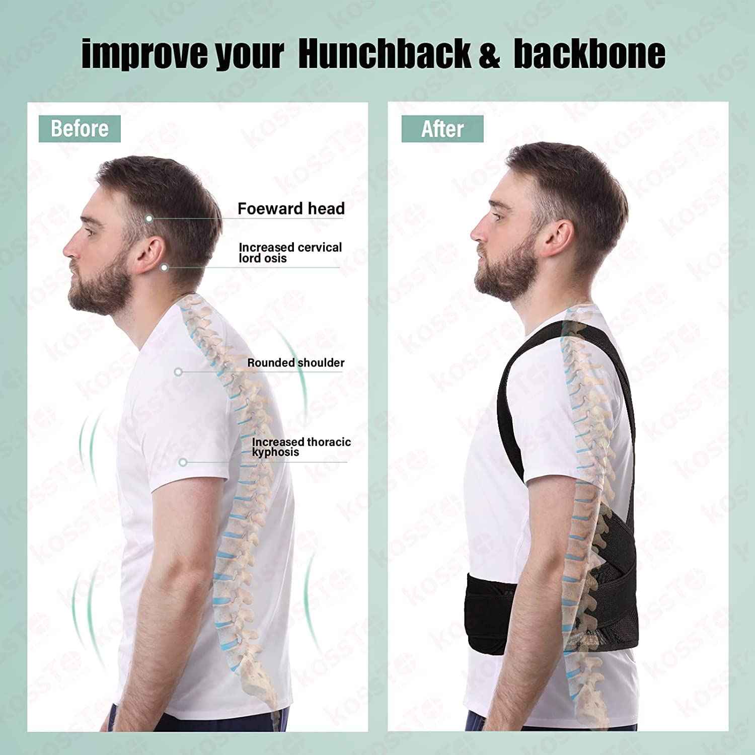 Adjustable Posture Corrector – Men & Women